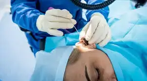 ترقيع طبلة الأذن